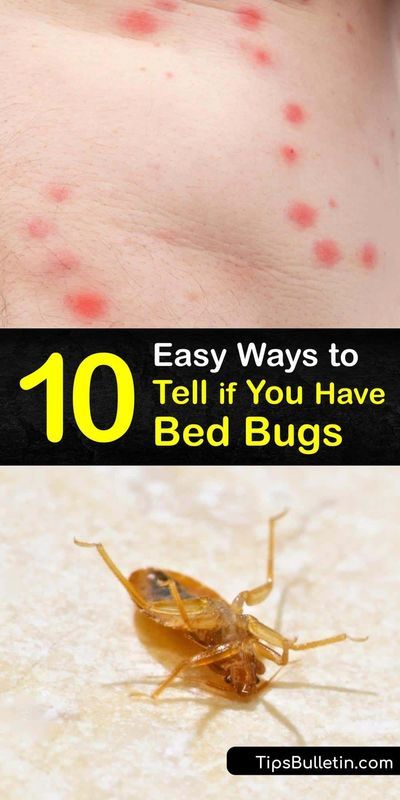 Bed Bug Bites Pictures, Bed Bug Trap, Signs Of Bed Bugs, Get Rid Of Bed Bugs, Bug Trap, Bug Activities, Kill Bed Bugs, Easy Juice Recipes, Vegan Probiotics