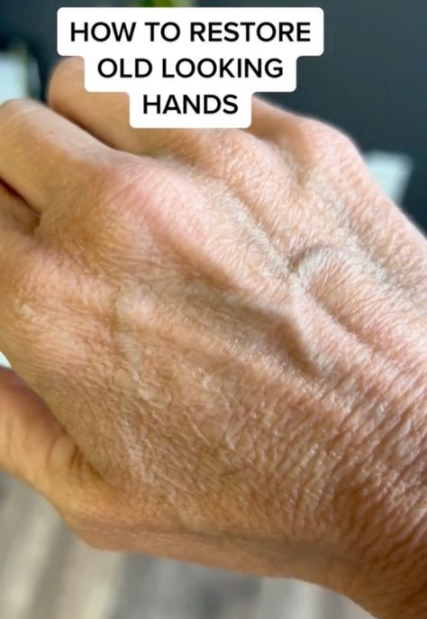 Hand Wrinkles Remedies, Hand Rejuvenation Anti Aging, Anti Aging For Hands, How To Get Pretty Hands, Make Hands Look Younger, Aged Hands, Wrinkly Hands, Hand Care Routine, Anti Aging Hand Cream