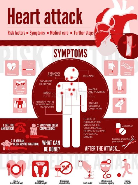 Illustration about Vector medical poster heart attack. Symptoms of the disease. Prevention. Illustration of cute sick girl. Illustration of cardiology, disease, cute - 159007627 Heart Infographic, Disease Infographic, Foot Reflexology Massage, World Heart Day, Types Of Diseases, Medical Posters, Health Guru, Health Signs, Sciatic Nerve Pain