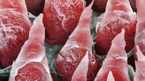 A high energy beam scanner, called a scanning electron micrograph, was used to capture this image, which shows the surface of a human tongue. The protruding objects, called filiform papillae, can sense pressure. The flaky appearance of the papillae results from the fact that they are constantly shedding their skin to increase sensitivity. Human Tongue, Microscope Images, Scanning Electron Microscope, Scanning Electron Micrograph, Microscopic Photography, Micro World, Micro Photography, Microscopic Images, Under A Microscope