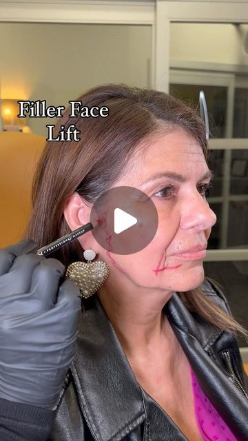 LIFTED BEAUTY on Instagram: "Filler Face Lift 🤩  To book an appointment text or call our office at (562) 331-6543   Click the link in our bio to see our online schedule to book an appointment with one of Our Medical Providers 📲 . Want More Info Before Coming in? Book A Free Consultation Call with Our Patient Care Coordinator ✨ . $45.00 Booking Fee Required To Book An Appointment 💰 . ⚠️Cancellation Policy ⚠️ $100 will be charged if appointment is not canceled within 48hrs of Scheduled Appointment Time . All products are FDA approved. Please visit the manufacturers website of the products that we use for all risk and side effects 🙌🏼 . All our treatments are customized to fit our patients anatomy and needs. Keep in mind that the number of units, syringes, threads or sessions needed will Threading Face Lift, Filler Face Lift, Face Fillers Before And After Jaw, Mid Face Filler, Facial Contouring Fillers, Lip Flip Vs Filler, Facial Fillers Before And After, Smile Line Fillers Before And After, Lower Face Lift Before And After