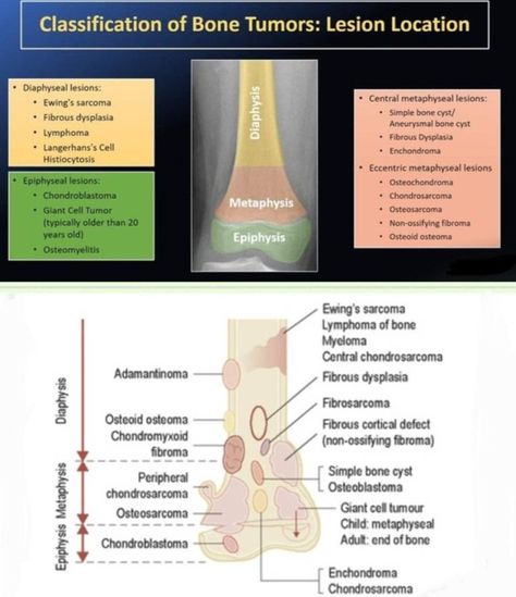 Langerhans Cell Histiocytosis, Langerhans Cell, Diagnostic Imaging, Medical Coding, Radiology, Natural Skin, Anatomy, Medical, Coding