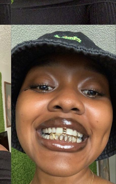 Gap Grillz, Teeth Gap, Girl Grillz, Teeth Aesthetic, Pretty Teeth, Grillz Teeth, Diamond Teeth, Dope Jewelry Accessories, Gap Teeth