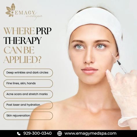 Revitalize your skin with PRP therapy—use your body's own platelet-rich plasma to boost collagen, improve texture, and achieve a youthful glow. Book your Appointment Now: 📱 646-301-1334 🌐 www.bouncebackiv.com We also do mobile visits. Bringing infusions to your home, office, hotel, and events. #chemicalpeel #lipodissolve #lipfillers #larginine #GlutathioneInjections #RadiantSkin #HealthyGlow #SkinCare #BeautyTreatment #EvenTone #SkinHealth #NaturalGlow #ConfidenceBoost #BeautyJourney #Lo... Prp Therapy, Social Media Branding Design, Platelet Rich Plasma, Boost Collagen, Media Branding, Aesthetic Clinic, Skin Clinic, Love Your Skin, Deep Wrinkles