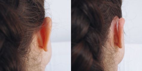 Hairstyles For Ears That Stick Out, Hairstyles For Protruding Ears, Protruding Ears Hairstyle, Ears That Stick Out, Health Signs, Spirit Science, Cotton Ball, Stick It Out, Behind Ear Tattoo