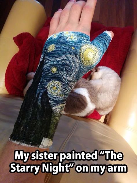 Love this Arm Cast, Cast Art, Arm Art, Iron Woman, Starry Night Van Gogh, Picture Day, Illustration Sketches, Art Google, Flash Tattoo