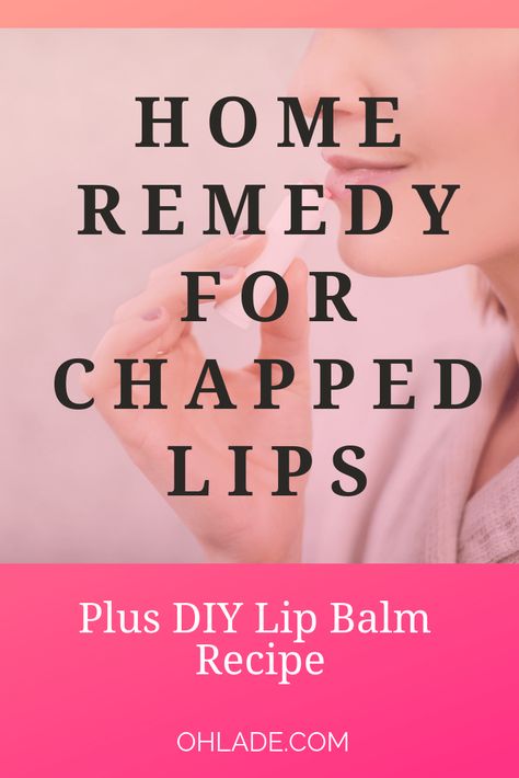 A Home Remedy for Chapped Lips and DIY Lip Balm Recipe. Don't let your lips get dry and cracked this season- try this awesome homemade chap-stick and lip balm scrub to keep lips looking healthy and pretty. #diylipbalmrecipe #homeremedyforchappedlips| OhLaDe Remedy For Chapped Lips, Home Remedies For Allergies, Lip Balm Recipe, Home Remedies For Warts, Diy Lip Balm Recipes, Warts Remedy, Balm Recipe, Natural Remedies For Migraines, Lip Balm Recipes