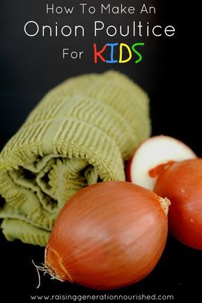 How To Make An Onion Poultice For Kids Onion Poultice, Cough Remedies For Kids, Chest Congestion Remedies, Cold And Cough Remedies, Sick Remedies, Great Grandparents, Chest Congestion, Home Remedy For Cough, Natural Cold Remedies