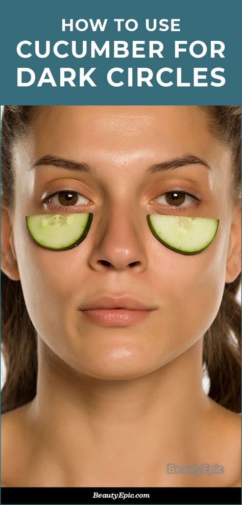 How to Remove Dark Circles with Cucumber? Cover Up Dark Circles Under Eyes, Dark Circle Remedies, Cucumber On Eyes, Brown Spots On Skin, Lotion For Oily Skin, Dark Eye Circles, Brown Spots Removal, Brown Spots On Face, Remove Dark Circles