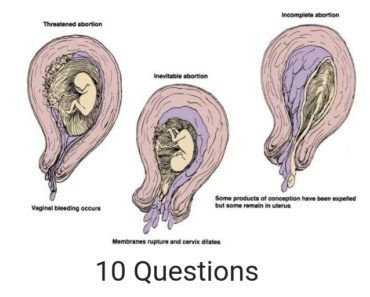 Uterine Rupture Practice Exam - RNpedia Fetal Monitoring, Fetal Heart Rate, Child Nursing, Active Labor, Pregnant Nurse, Stages Of Labor, Nursing Exam, Iv Infusion, Nurse Midwife