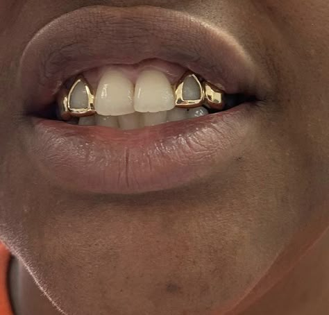 Side Tooth Grill, Grillz For Men, Silver Grillz Men, Grillz Teeth Men, Men Grillz, Grillz Men, Gold Teeth Grills, Open Face Grillz, Girl Grillz