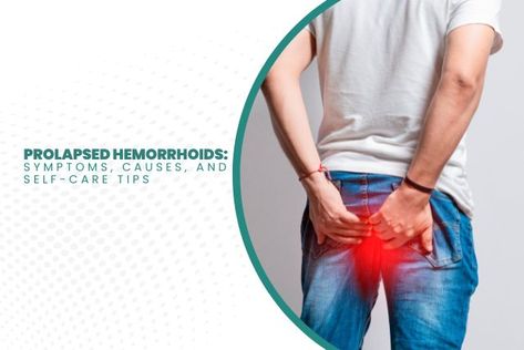 Prolapsed Hemorrhoids: Symptoms, Causes, and Self-Care Tips Stool Softener, Drink Plenty Of Water, Management Tips, Gut Health, Self Care Routine, Natural Remedies, Self Care, Lifestyle