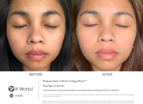 Collagen Before And After Pictures, It Works Marketing, Aging Backwards, Collagen Protein, Healthy Joints, Younger Skin, It Works Products, Hair Skin Nails, Radiant Skin