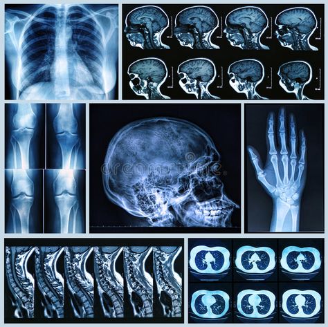 Radiography of Human Bones stock photo X Ray Tube, Digital Radiography, Harley Davidson Artwork, Bone Fracture, Bone Stock, Mri Scan, Medical School Motivation, Human Bones, Rad Tech