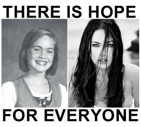 Hope For Everyone Megan Fox Before After, Plastic Surgery Quotes, Surgery Quotes, Image Memes, Megan Fox, Cosmetic Surgery, Plastic Surgery, Funny Images, I Laughed