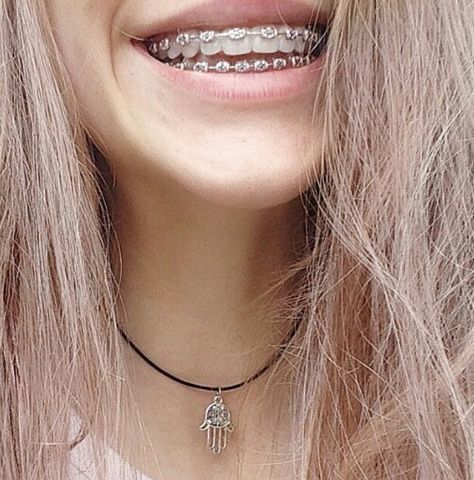 Braces Retainer, Braces And Glasses, Cute Braces Colors, Braces Tips, Getting Braces, Braces Girls, Cute Braces, Brace Face, Braces Colors