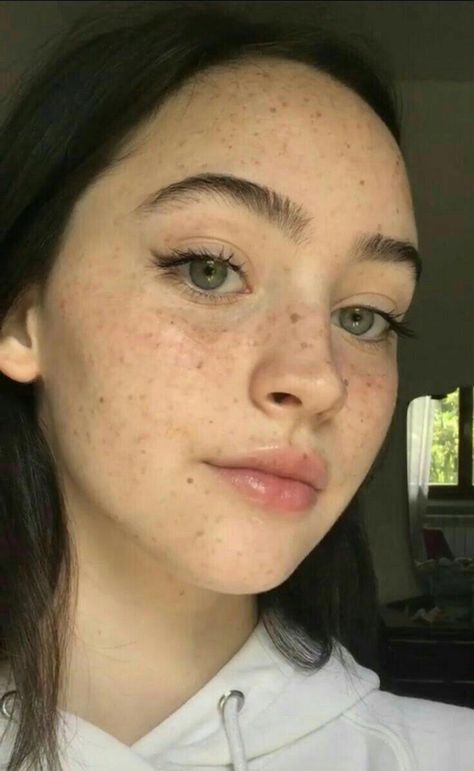 Girl With Moles, Girl With Moles On Face, Moles On Face Aesthetic, Moles Aesthetic, Freckles And Moles, Moles On Face, Women With Freckles, Beautiful Freckles, Freckles Girl