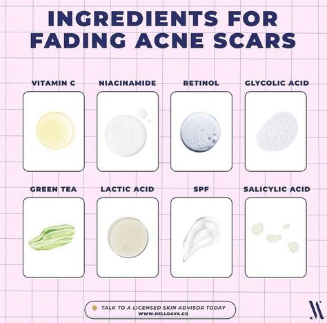 These are the best ingredients to fade acne marks💁‍♀️ #skincare #acnescars | Instagram Shoulder Acne, Pimples On Scalp, Pimple Causes, Fade Acne Marks, Good Leadership Skills, Post Acne Marks, Clean Blackheads, Rule Of Thumb, Skin Secrets