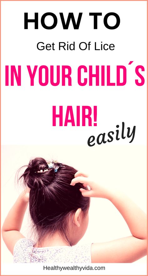 The Easy way to treat kids headlice #headlice #lice #nits #parentingadvice #parentingtips #babies #toddlers #kids #hair #howto Toddler Sleep Schedule, How To Treat Lice, Lice Nits, Lice Shampoo, Hair Lice, Lice Removal, Head Louse, Simple Health, Baby Sleep Problems