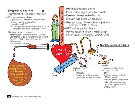 Day of Surgery - Preoperative Teaching, Nursing Considerations Cna School, Perioperative Nursing, Nursing School Scholarships, Nursing School Prerequisites, Nursing Mnemonics, Surgical Nursing, Nursing Schools, Medical Surgical Nursing, Nursing School Survival