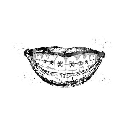 Check out this awesome 'Teeth+braces' design on @TeePublic! Teeth With Braces Drawing, Smile With Braces Drawing, Braces Drawing, Teeth Whitening Mouthwash, Smile Tips, Teeth Aesthetic, Dentist Art, Teeth Drawing, Smile Drawing