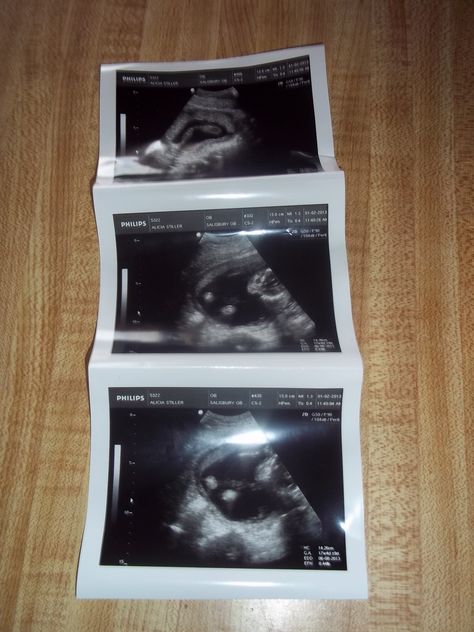 first pictures of our baby Pregnant Prank, Black Love Movies, Fake Pregnancy, Ultrasound Technician, Ultrasound Tech, Baby Pictures Newborn, Baby Hospital, Story Ideas Pictures, Women Dresses Classy