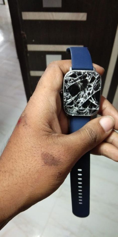 My Amazfit GTS was broken while i was travelling fromHyderabad to Kadapa in Bike Accident Fake Accident Snap Bike, Bike Accident Pictures, Bike Accident Hand Dpz, Accident Pic Of Bike, Lowkey Relationship, Lowkey Relationship Pictures, Bike Accident, Mt Bike, Cute Cat Tattoo