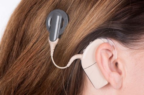 Cochlear Implants, Speech And Hearing, Human Ear, Mri Scan, Cochlear Implant, Cleveland Clinic, Train Your Brain, Hearing Loss, Speech Language Pathologists