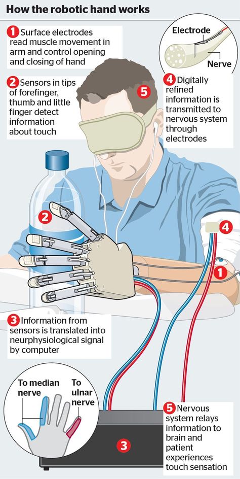 Robotic Prosthetics, Bionic Hand, Medical Engineering, Robotics Engineering, Biomedical Engineering, Sense Of Touch, Human Touch, Medical Technology, Robot Design