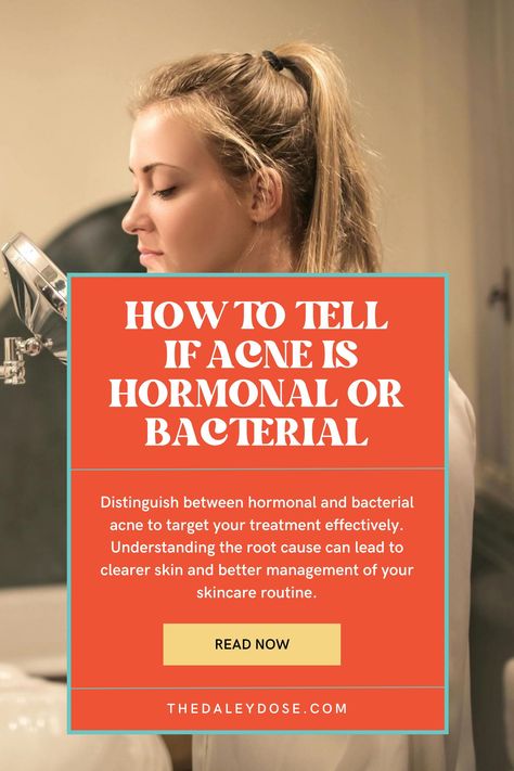 Discover the secrets to identifying hormonal versus bacterial acne with our expert insights! From the location of pimples to timing of breakouts, learn the key differences that can help you pinpoint the root cause of your skin woes. Take charge of your skincare routine and say goodbye to acne frustrations. #SkinCareExperts #ClearSkin #AcneAwareness Acne Places Meaning, How To Help Hormonal Acne, Best Products For Hormonal Acne, How To Fix Hormonal Acne, Hormonal Acne Skincare Routine, Chin Acne Remedies, Bacterial Acne, Hormonal Acne Diet, Hormonal Acne Supplements