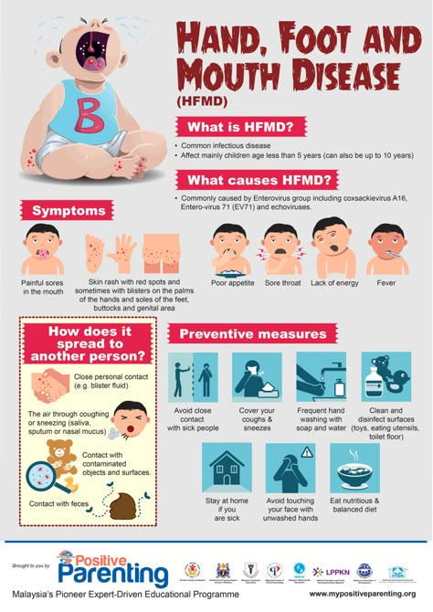 Hand, Foot and Mouth Disease (HFMD) | Positive Parenting School Nurse Elementary, Hand Foot And Mouth Disease, School Nurse Ideas, Nurse Ideas, Pediatric Medicine, School Nurse Office, Are Essential Oils Safe, Sick Remedies, School Nursing