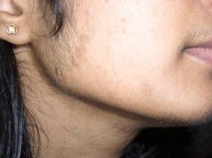 Female Sideburns, Sideburns Women, Female Facial Hair, Facial Hair Growth, Unwanted Hair Growth, Fitness Recipes, Arabian Beauty Women, Normal Hair, Unwanted Hair