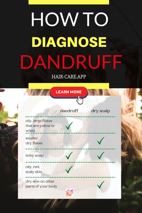 Are you suffering from severe dandruff? Or is it just dry scalp? Before chasing the DIY dandruff remedies, make sure you know what's your exact scalp condition: is it actually dandruff or dry scalp? Diagnostics is the first thing you should do before buying hair products or looking for DIY scalp remedies #haircare #dandruff #diyhaircare #hairproducts Haircare Dandruff, Dandruff Tips, Best Hair Routine, Scalp Remedies, Severe Dandruff, Home Remedies For Dandruff, Grow Long Healthy Hair, Dandruff Remedy, Flaky Scalp