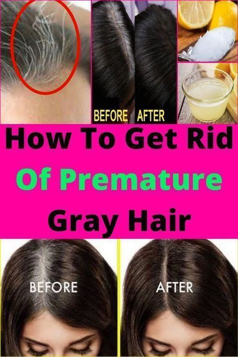 Say Goodbye To Your Grey Hair With Just These 3 Ingredients - Get Rid Of Grey Hair Permanently Get Rid Of Grey Hair, Grey Locks, Grey Hair Before And After, Grey Hair Remedies, Premature Grey Hair, Iconic Hair, Hair Growth Foods, Hair Mask For Growth, Hair Care Growth