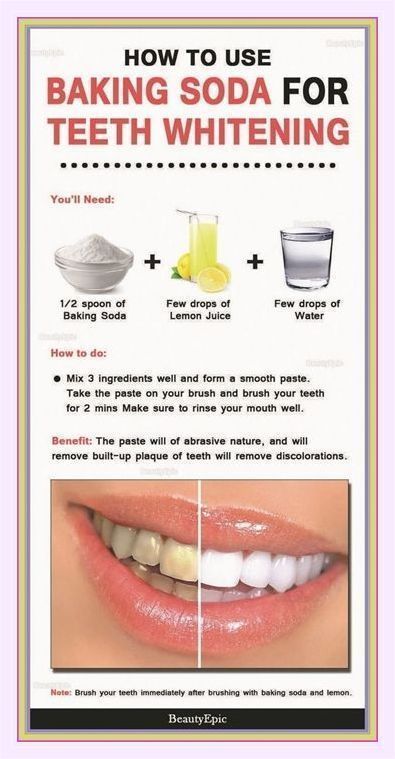 Brushing With Baking Soda, Baking Soda Lemon Juice, Baking Soda Teeth, Peroxide Teeth Whitening, Baking Soda Teeth Whitening, Mouth Health, Teeth Whitening Homemade, Baking Soda And Lemon, Teeth Whitening Remedies