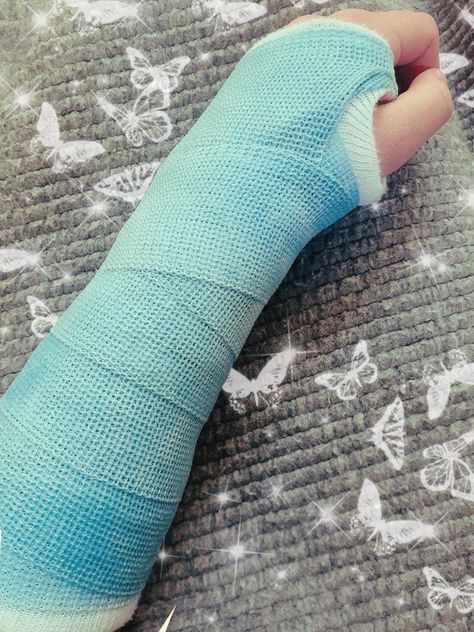 Fracture Hand Plaster Girl, Hand Fracture Pics With Plaster, Fracture Hand Snapchat, Hand Fracture Pics, Pic Birthday, Hand Fracture, Alien House, Dr Aesthetic, Fake Injury