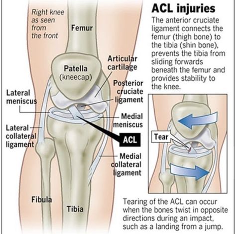 Acl Surgery, Acl Tear, Cruciate Ligament, Musculoskeletal System, Muscle Anatomy, Human Anatomy And Physiology, Orthopedic Surgery, Medical Anatomy, Knee Pain Relief