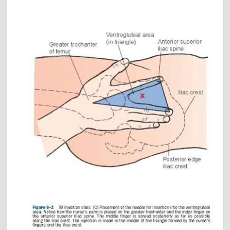 IM VG Ventrogluteal Injection, Nclex Notes, Injection Sites, Im Injection, Nursing Information, Nursing Fun, Psych Nurse, College Nursing, Nursing Life