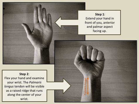 Palmaris Longus, Happy January, Ancient Relics, Wisdom Teeth, Nerd Alert, The Trip, Anatomy, Evolution, Okay Gesture