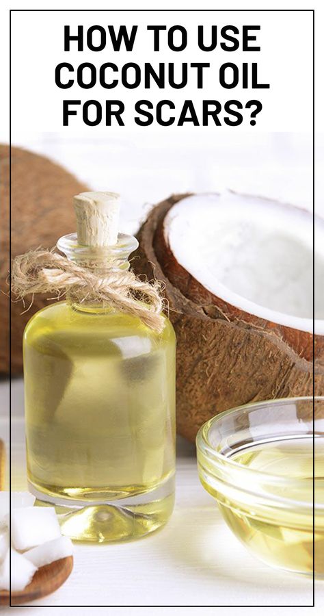 Does Coconut oil Help with Scars And How To Use It? Stretch Mark Cream Pregnancy, Diy Body Lotion, Whipped Coconut Oil, Scar Remedies, Oils For Scars, Homemade Beauty Recipes, Scar Removal Cream, Scar Cream, Sick Remedies