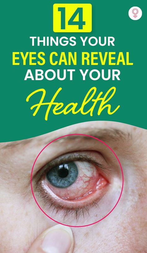 Eye Facts, Home Remedy For Cough, Eye Exercises, Cold Sores Remedies, Vision Eye, Sore Eyes, Healthy Eyes, Natural Cold Remedies, Cold Home Remedies