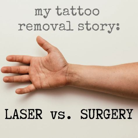 Excision Tattoo, Surgical Tattoo, Contour Tattoo, Saniderm Tattoo Healing, Tattoo Removal Before And After, Tattoo Correction, Laser Tattoo Removal Healing, Laser Tattoo Removal Before And After, Lazer Removed Tattoo Before And After