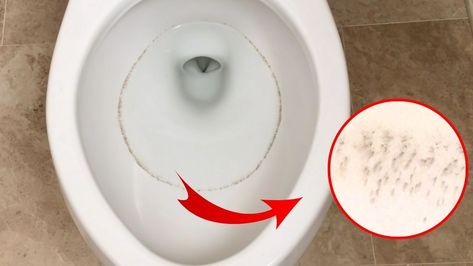 3 Effective Solutions For Recurring Toilet Ring Clean Toilet Bowl Ring, Toilet Bowl Ring Remover, Cleaning Toilet Stains, Toilet Bowl Ring, Toilet Ring, Toilet Stains, Clean Rings, Diy Joy, Clean Toilet Bowl