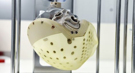 Most Advanced Artificial Heart Approved For Sale in Europe, Raising Hopes for Those Awaiting Transplants! https://www.goodnewsnetwork.org/carmats-artificial-heart-to-be-available-for-purchase-in-2021/ Artificial Heart, Normal Heart, Resume Work, Human Heart, Plastic Laundry Basket, Science And Technology, France, Iphone, For Sale