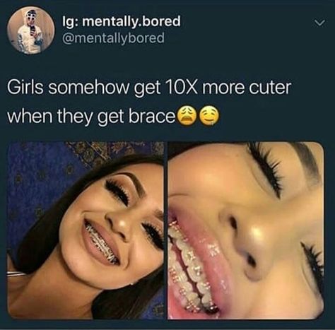 Braces Hacks, Braces Colours, Invisible Teeth Braces, Girls With Braces, Natural Teeth Whitening Diy, Cute Braces Colors, Straight Smile, Braces Tips, Getting Braces