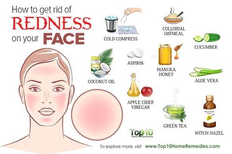 Redness Remedy, Reduce Face Redness, Redness On Face, Remove Skin Tags Naturally, Bad Acne, Skin Redness, Face Acne, Unwanted Hair Removal, Skin Treatments