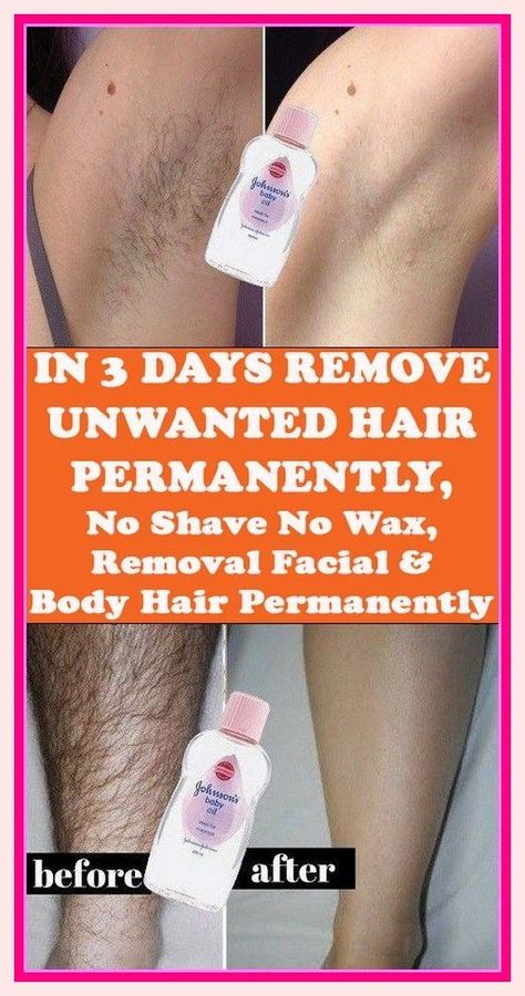 Outstanding piece of writing. Best Permanent Hair Removal, Chin Hair Removal, Permanent Hair Removal Cream, Upper Lip Hair Removal, Back Hair Removal, Best Facial Hair Removal, Leg Hair Removal, Lip Hair Removal, Ingrown Hair Removal