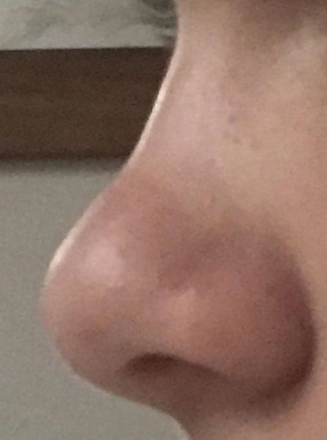 Snub Nose Human, Upturned Nose, Lip Surgery, Bulbous Nose, Yoga Information, Job Inspiration, Straight Nose, Perfect Nose, Small Nose