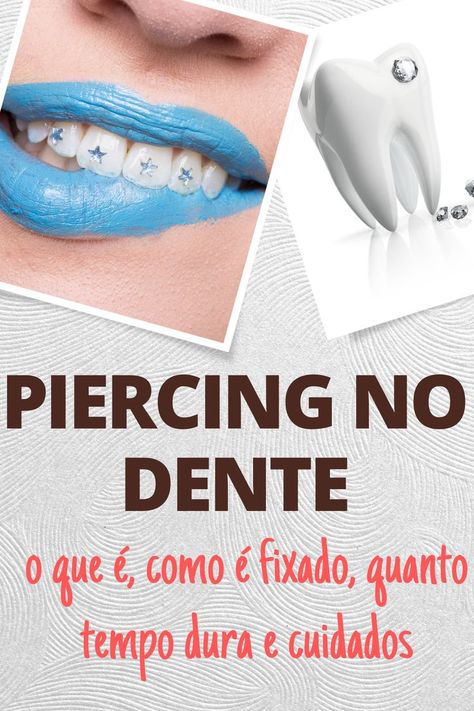 Piercing no dente: o que é, como é fixado, quanto tempo dura e cuidados
O piercing no dente já vem sendo utilizado há alguns anos, sendo que atingiu seu auge nos anos 2000 e agora está voltando a ser tendência.
Mesmo que a técnica de fixação tenha mudado, o acessório em si permanece o mesmo, portanto, ele continua sendo apenas estético.
Confira mais a seu respeito no nosso post.
#piercing #piercingnaboca #piercingnodente #saúdebucal #cuidadoscomopiercing