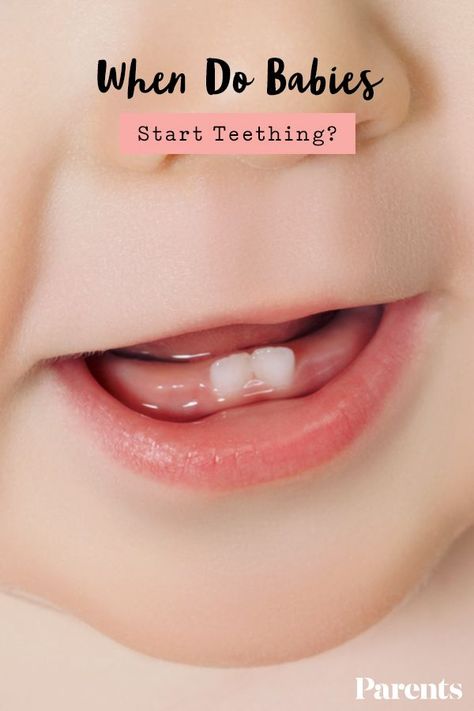 Smile Tips, Teething Symptoms, Baby Captions, Dental Photos, Longevity Diet, Dental Videos, Swollen Gum, Kids Teeth, Teething Babies